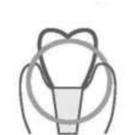 Contour design